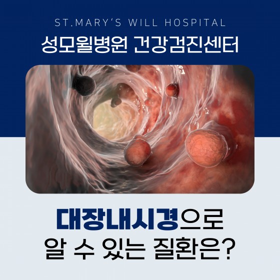 대장내시경으로 알 수 있는 질환과 검사 전 준비사항