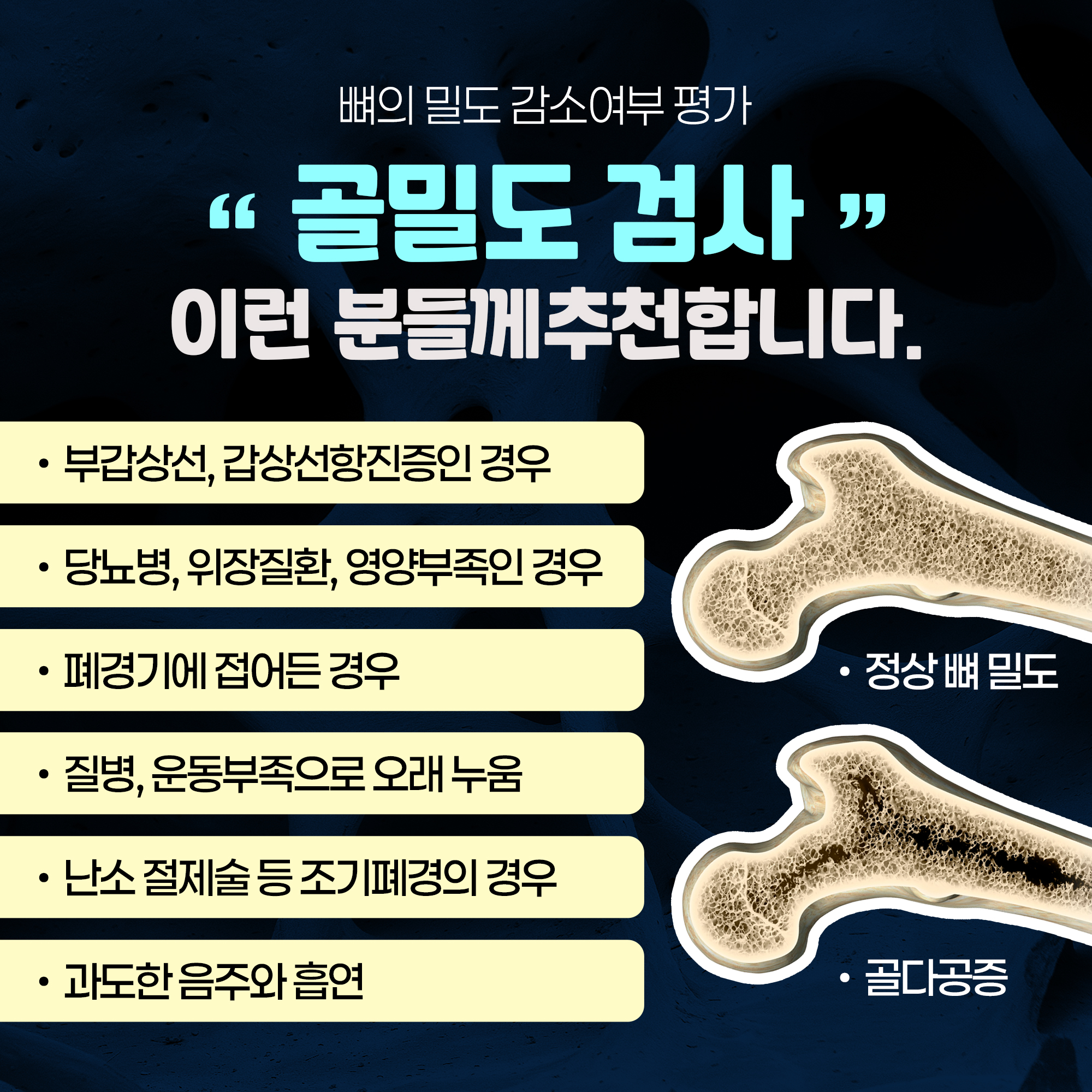 골밀도검사 이미지