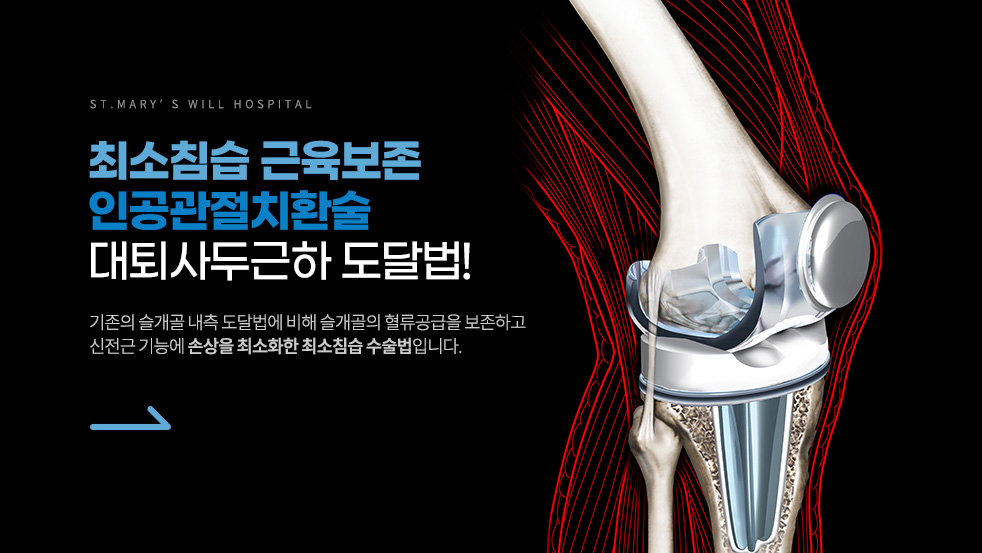 인공관절 치환술 이미지